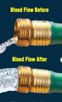 Water hose showing blood flow example.