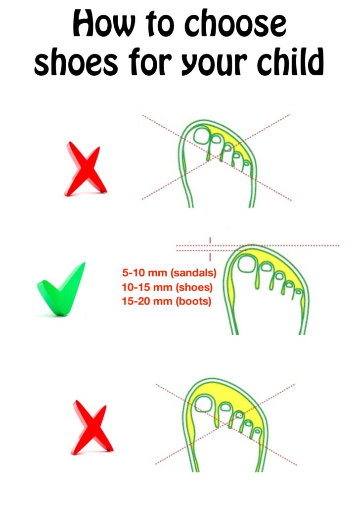 How to choose kids shoes for your child, diagram.